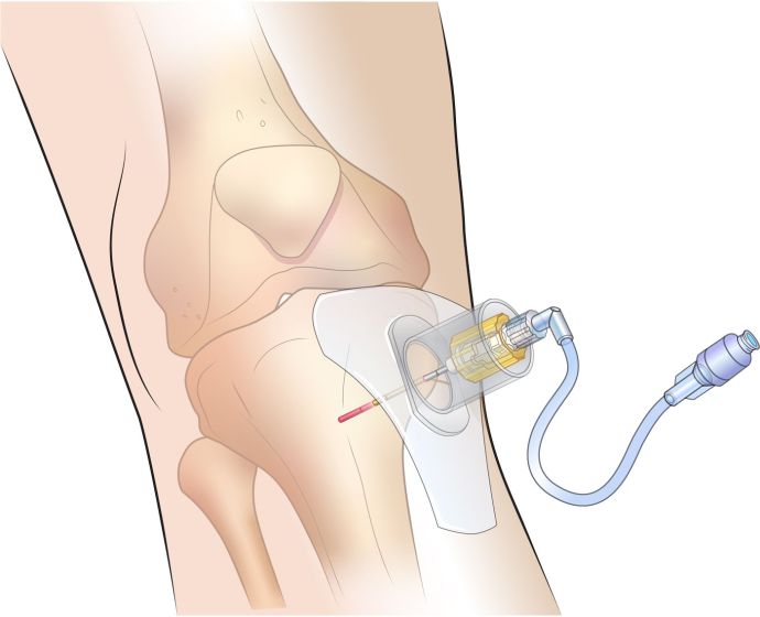 SAM IO Kit - Praetorian Consulting Store